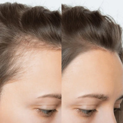 🌿 Rosemary Amino Acid Shampoo (Pack of 2) 🌿